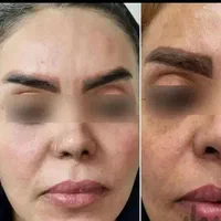 کرم معجزهvipصدرصداصلی ضدلک و روشن کننده|آرایشی، بهداشتی، درمانی|تهران, امام زاده حسن|دیوار