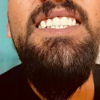 دندانسازی مددی با بیش از ۴۰ سال سابقه درخشان|خدمات آرایشگری و زیبایی|تبریز, |دیوار