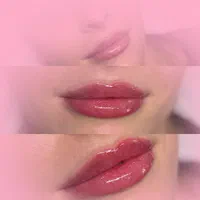 کلینیک تزریق ژل و بوتاکس آنزیم فیلر لب پزشک مطب|خدمات آرایشگری و زیبایی|کرج, گوهردشت|دیوار