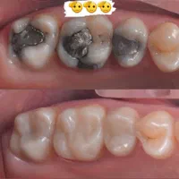 کلینیک دندانپزشکی نیاوران   (خدمات درمانی،ایمپلنت)|خدمات آرایشگری و زیبایی|تهران, نیاوران|دیوار