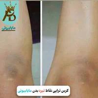 اولین مرکز روشن کننده بیکینی و زیربغل،مایابیوتی|خدمات آرایشگری و زیبایی|یاسوج, |دیوار