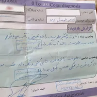 پژو پارس مدل ۸۷|خودرو سواری و وانت|خرم‌آباد, |دیوار