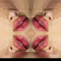 تزریق ژل لب صورت فیلر بوتاکس میکرونیلدینگ مزوتراپی|خدمات آرایشگری و زیبایی|شیراز, شهرک گلستان|دیوار