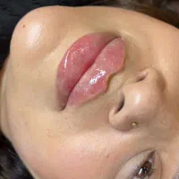 آموزش ژل و بوتاکس/لیفت نخ/لابیاپلاستی/ساکشن غبغب|خدمات آموزشی|تهران, فرمانیه|دیوار