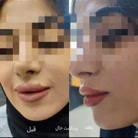 پوست صاف ویکدست میخوای متن آگهی روبخون+پیشنهادویژه|خدمات زیبایی و سلامت|قم, بکایی|دیوار