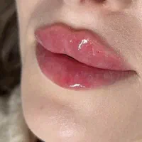 جشنواره لب فیلر ژل روسی بوتاکس زاویه سازی مادلینگ|خدمات آرایشگری و زیبایی|کرج, گوهردشت|دیوار