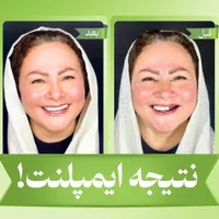 کلینیک تخصصی ایمپلنت دیجیتال5400/فوری/کاشت دندان|خدمات آرایشگری و زیبایی|تهران, پاسداران|دیوار
