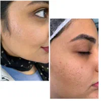 فیشیال و آبرسانی تخصصی/ خدمات و آموزش|خدمات آرایشگری و زیبایی|کرج, فاز ۲ مهرشهر|دیوار