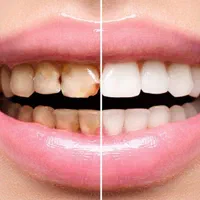 دندانپزشکی طرح لبخند|خدمات آرایشگری و زیبایی|قم, زنبیل آباد|دیوار