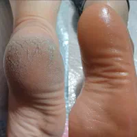 پاکسازی پوست|خدمات آرایشگری و زیبایی|بروجرد, |دیوار