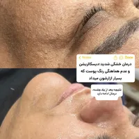 فیشال و خدمات تخصصی پوست توسط پیراپزشک در مطب پزشک|خدمات آرایشگری و زیبایی|مشهد, سجاد شهر|دیوار