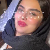 دکتر متخصص تزریق ژل لب روسی فیلر بینی زاویه پزشک|خدمات آرایشگری و زیبایی|تهران, پونک|دیوار