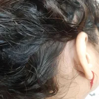 درمان صددرصدگیاهی رشک وشپش|خدمات آرایشگری و زیبایی|گرگان, |دیوار