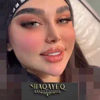 تزریق تخصصی ژل ومادلینگ وبوتاکس وهایفو|خدمات آرایشگری و زیبایی|کرمانشاه, |دیوار
