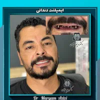 خدمات ترمیم دندان ،مطمین ترین تکنیک های دندانپزشکی|خدمات آرایشگری و زیبایی|شیراز, معالی‌آباد|دیوار