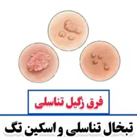 درمان زگیل تناسلی تک جلسه لیزر پیشرفته درمطب متخصص|خدمات آرایشگری و زیبایی|شیراز, قدوسی غربی|دیوار