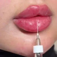 تزریق ژل ۶۰۰