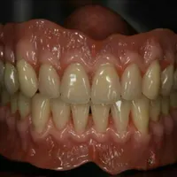 دندانسازی/دندان مصنوعی/بامجوزرسمی و۷۰سال سابقه|خدمات آرایشگری و زیبایی|مشهد, پایین خیابان|دیوار
