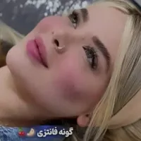 ژل بوتاکس آنزیم مطب پزشک|خدمات آرایشگری و زیبایی|کرج, عظیمیه|دیوار