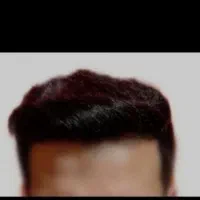 کاشت مو و ابرووریش حداکثر تراکم باضمانت نامه کتبی|خدمات آرایشگری و زیبایی|شیراز, عفیف‌آباد|دیوار