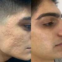 فیشیال و آبرسانی تخصصی/ خدمات و آموزش|خدمات آرایشگری و زیبایی|کرج, فاز ۲ مهرشهر|دیوار