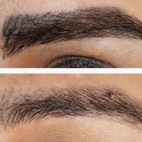پاک‌کردن تاتو های قدیمی یابدرنگ(ریمو)