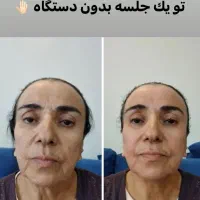 درمان تخصصی ،فیشال و اسیدتراپی و ماساژ درمانی صورت|خدمات آرایشگری و زیبایی|شیراز, رحمت‌آباد|دیوار