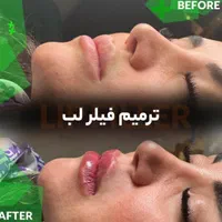 جشنواره مادلینگ و ژل لب و لیفت ابرو با نخ|خدمات آرایشگری و زیبایی|تهران, صادقیه|دیوار