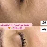فیشال و خدمات تخصصی پوست توسط پیراپزشک در مطب پزشک|خدمات آرایشگری و زیبایی|مشهد, سجاد شهر|دیوار