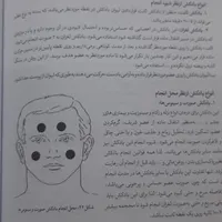 رگ گیری بادکش حجامت زالو و تول گیری|خدمات آرایشگری و زیبایی|تهران, توحید|دیوار