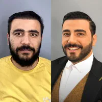 گریم داماد عقد عروسی پروتزآرایشگاه فشیال میکاپ|خدمات آرایشگری و زیبایی|مشهد, وکیل‌آباد|دیوار