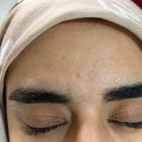 خال برداری کوچک کردن بینی رفع کک و مک غبغب پشت پلک