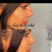 جراح پلک بلفارو ژل چربی صورت ساکشن شکم بوتاکس لیزر|خدمات آرایشگری و زیبایی|یزد, |دیوار