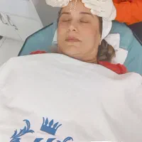 آموزش فیشال،فیشیال، فشیال، دتوکس تراپی،مزونیدلینگ|خدمات آموزشی|تهران, جنت‌آباد مرکزی|دیوار