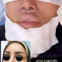 کلینیک زیبایی دکتر شهرام مرادی انجام جراحی زیبایی|خدمات آرایشگری و زیبایی|کرمانشاه, |دیوار