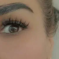 کاشت مژه