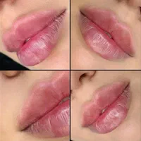 تخفیف تزریق ژل،ژل لب روسی تخصصی،بوتاکس|خدمات آرایشگری و زیبایی|اسلام‌شهر, شهرک انبیا|دیوار