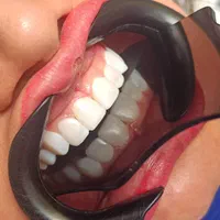 دندانپزشکی نقدواقساط باتخفیفات بینظیر فقط بمدت۷روز|خدمات آرایشگری و زیبایی|شیراز, ملاصدرا|دیوار