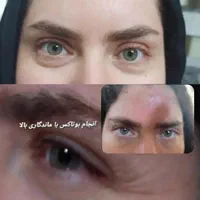 فیلر بوتاکس اقتصادی فقط ۴۰۰|خدمات آرایشگری و زیبایی|اصفهان, شهشهان|دیوار