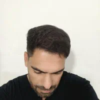 کاشت مو تیم شیرازی در مجهزترین کلینیک تهران|خدمات آرایشگری و زیبایی|پردیس, |دیوار