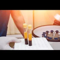 تخصصی پی آر پیprp مزو بوتاکس فیلر ژل حجامت فصد|خدمات آرایشگری و زیبایی|اصفهان, جلفا|دیوار