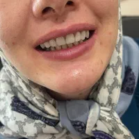 ساخت انواع دندان مصنوعی + لابراتوار دندانساری|خدمات آرایشگری و زیبایی|تهران, یافت آباد جنوبی|دیوار