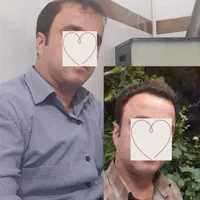 کاشت مو، ابرو، ریش حرفه ای توسط پزشک متخصص پوست مو|خدمات آرایشگری و زیبایی|شیراز, قدوسی غربی|دیوار