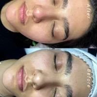 فیشال ، پاکسازی پوست ، مراقبت از پوست ،روتین پوستی|خدمات آرایشگری و زیبایی|اصفهان, سیچان|دیوار