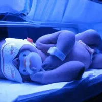 پاور دستگاه درمان زردی نوزاد(فتو تراپی)