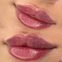 ژل لب روسی/بوتاکس/فیلر زیر چشم/زاویه فک لیزر بدن|خدمات آرایشگری و زیبایی|تهران, ستارخان|دیوار