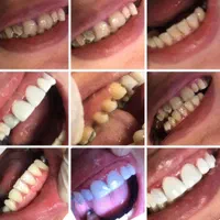 دندانپزشکی و دندان سازی خیریه چمران (جراحی. زیبایی