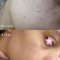 فیشال ، پاکسازی پوست ، مراقبت از پوست ،روتین پوستی|خدمات آرایشگری و زیبایی|اصفهان, سیچان|دیوار