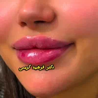 بوتاکس مصپورت فقط۴۹۰ کلینیک زیبایی دکتر فرشیدکریمی