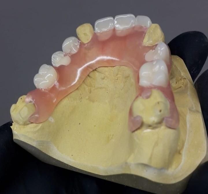 آموزش  دندانسازی مصنوعی به روش جدید.|خدمات آموزشی|شیراز, پارک آزادی|دیوار